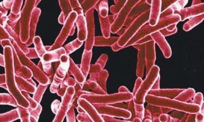 100-day TB elimination campaign far from achieving main objective