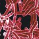 100-day TB elimination campaign far from achieving main objective