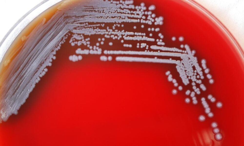 Environmental mapping reveals melioidosis in Odisha peak during monsoon