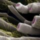 Out-of-balance bacteria is linked to multiple sclerosis, can predict severity: new research