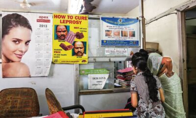 Centre urges states to implement new treatment regimen for leprosy