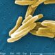 Indigenous TB test can enhance accuracy, speed up testing
