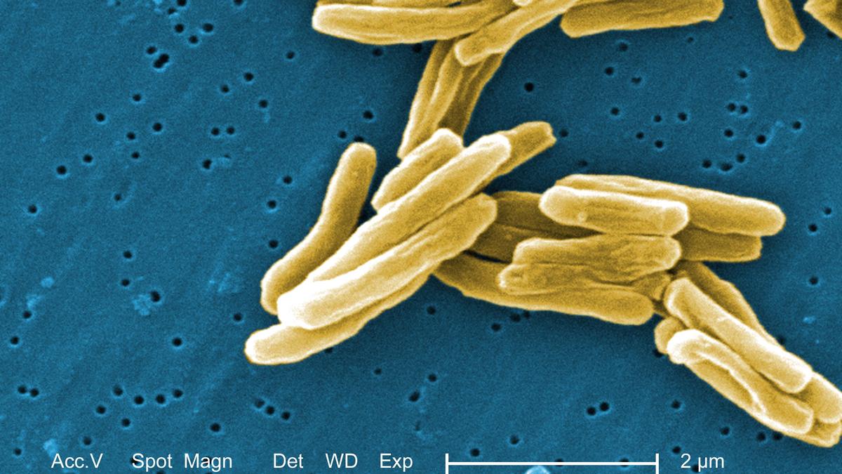Indigenous TB test can enhance accuracy, speed up testing