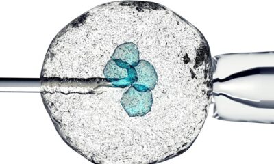 Trials demonstrate safety of stem cell therapy for Parkinson’s