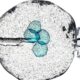 Trials demonstrate safety of stem cell therapy for Parkinson’s