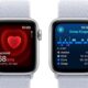 Apple Watch SE in 2025: Smartwatch that still makes sense for most people | Mint
