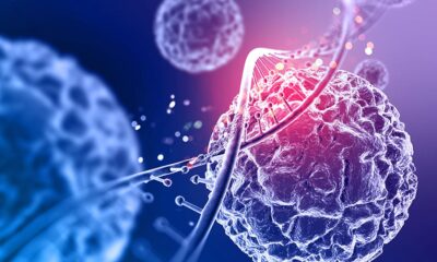 CAR-T therapy can be safely manufactured at hospital, finds ICMR-funded trial led by CMC Vellore