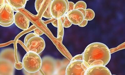 Surveillance, R&D innovation and communication are key levers for India to lead the fight against AMR