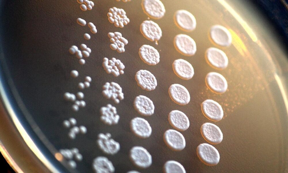 The curious case of the yeast modified to develop brain defects