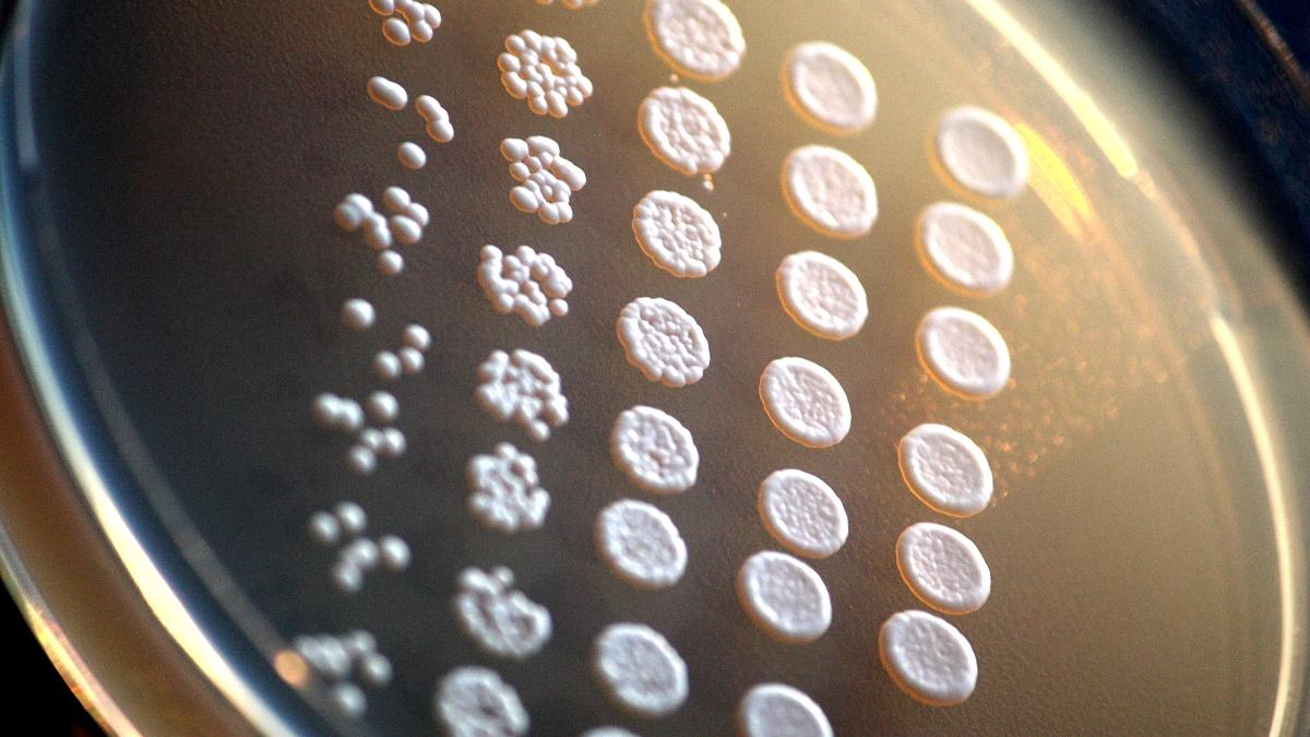 The curious case of the yeast modified to develop brain defects