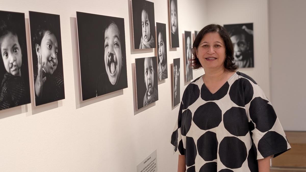Smile Train India’s photo exhibition on children with clefts at KNMA Delhi is a powerful portrayal of reality and hope