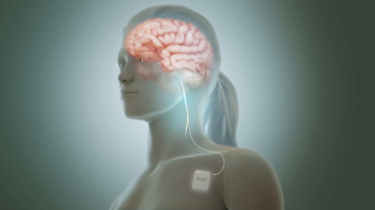 Deep-brain stimulation: nudging neurons