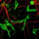 Immune cells’ fat blocks brain’s ability to clean Alzheimer’s plaques