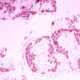 Rare diseases have a lot to gain from greater awareness