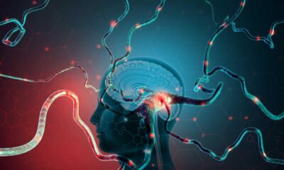 Stimulating brain with weak electric currents may help improve learning maths, study suggests