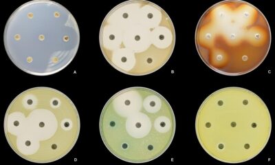 A bistable gene in a deadly bacterium offers a clue to beating it