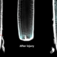 Reshaping during healing in plants