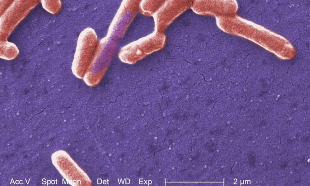 Scientists turn E. coli bacteria into a mercury sensor