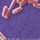 Scientists turn E. coli bacteria into a mercury sensor