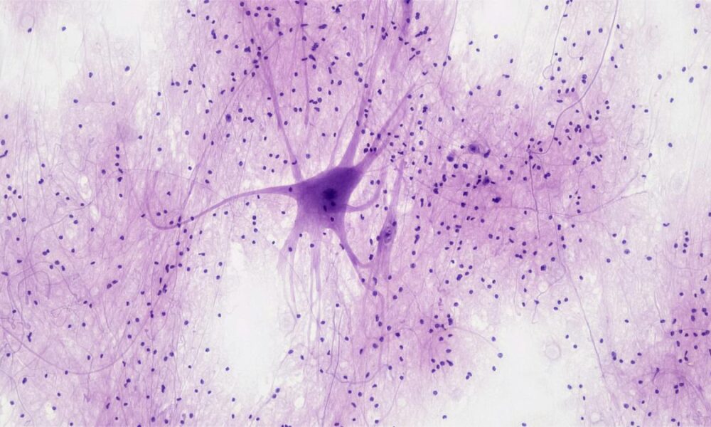 Are new neurons born in the adult human brain? Study revives debate