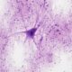 Are new neurons born in the adult human brain? Study revives debate
