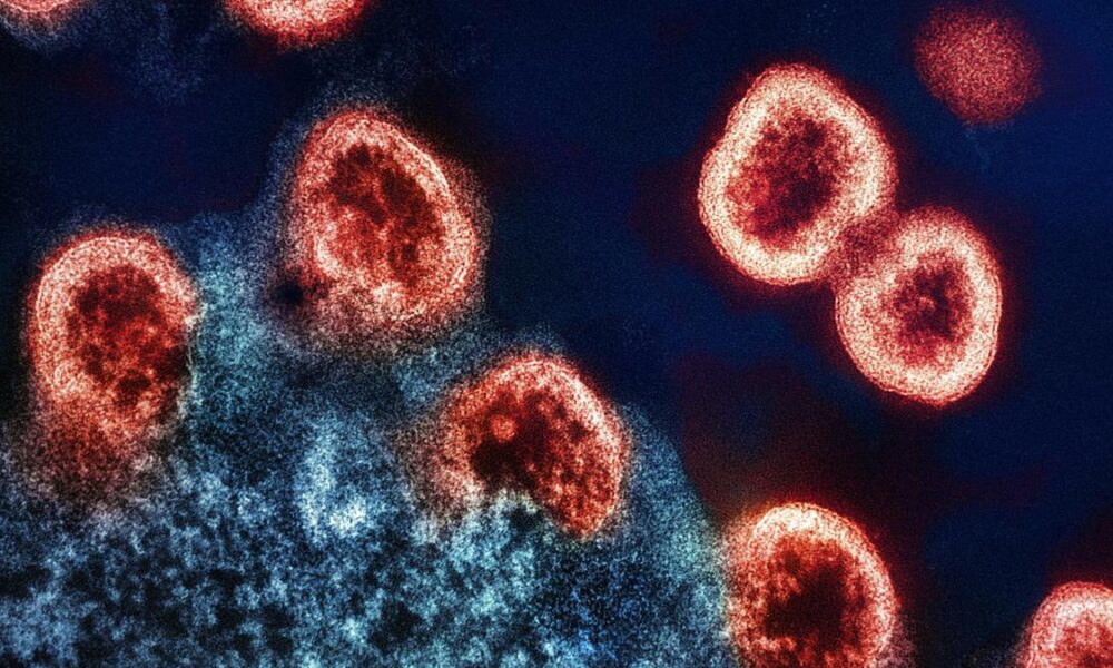 HIV strains in India resist some top broadly neutralising antibodies
