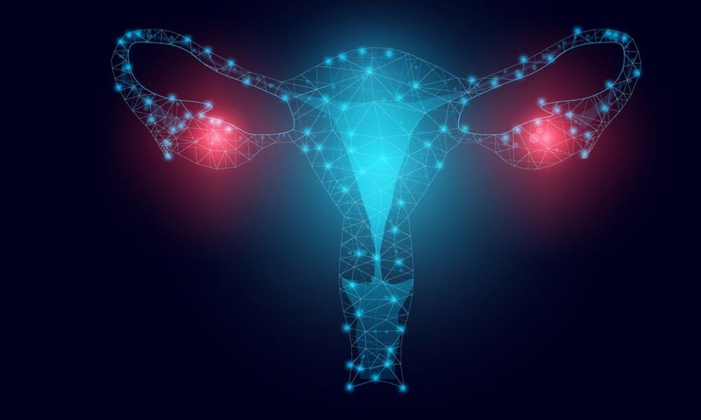New study finds how calcium and pH regulate ovarian cancer spheroids