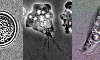 Why does the ‘brain-eating amoeba’ eat the brain?