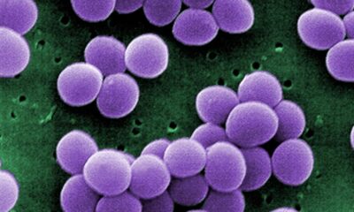 New physics-based model shows healthy guts resist microbial chaos