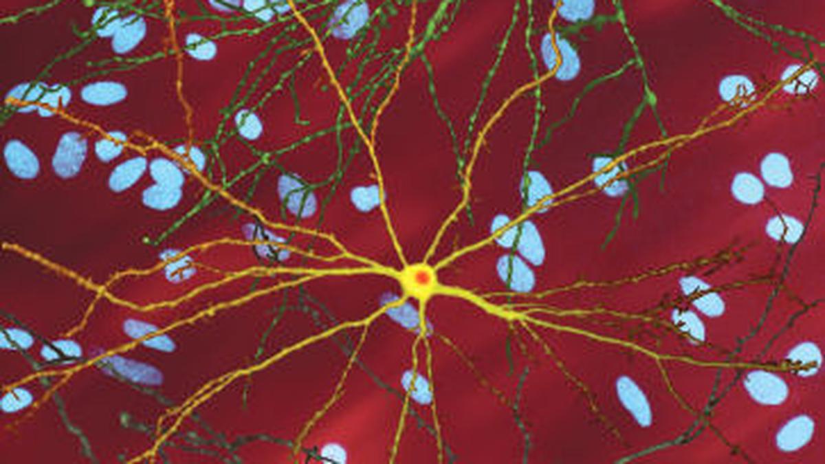 Researchers, families confront Huntington’s with rhythm and resolve