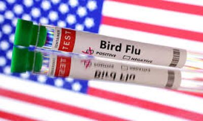 U.S. resident infected with H5N5 — a different type of bird flu