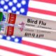 U.S. resident infected with H5N5 — a different type of bird flu