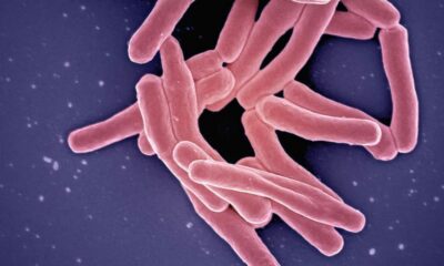 Could rewiring macrophage metabolism make TB treatments shorter?