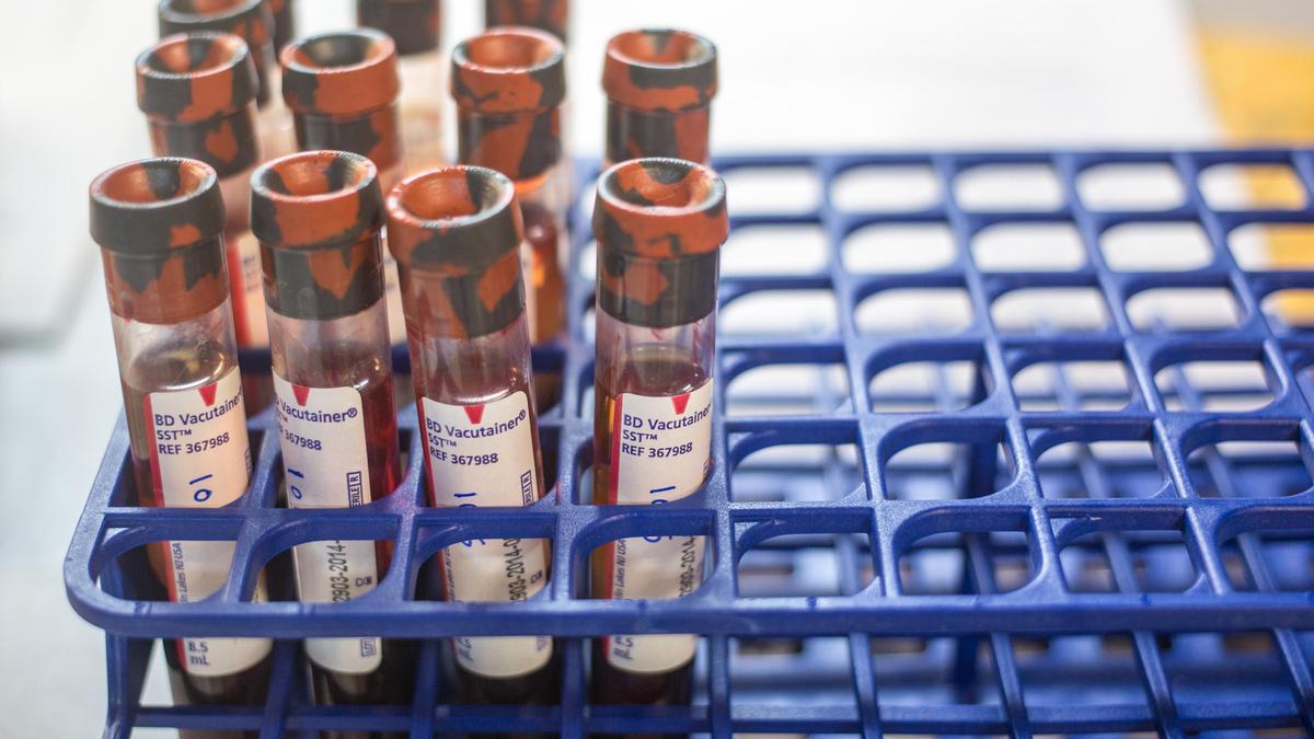 Flosdorf, Mudd, and a way to handle blood