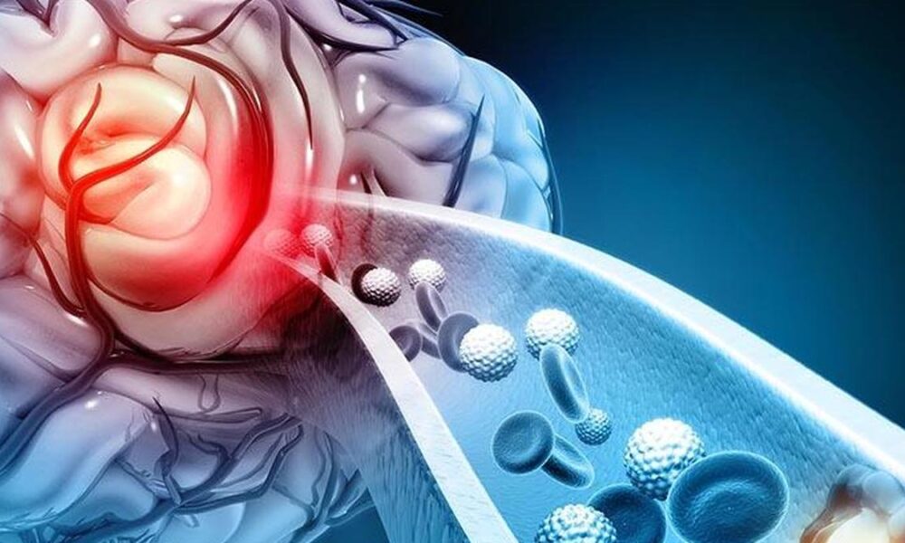 Indigenously built stroke device approved on domestic trial data, launch set for February 2026