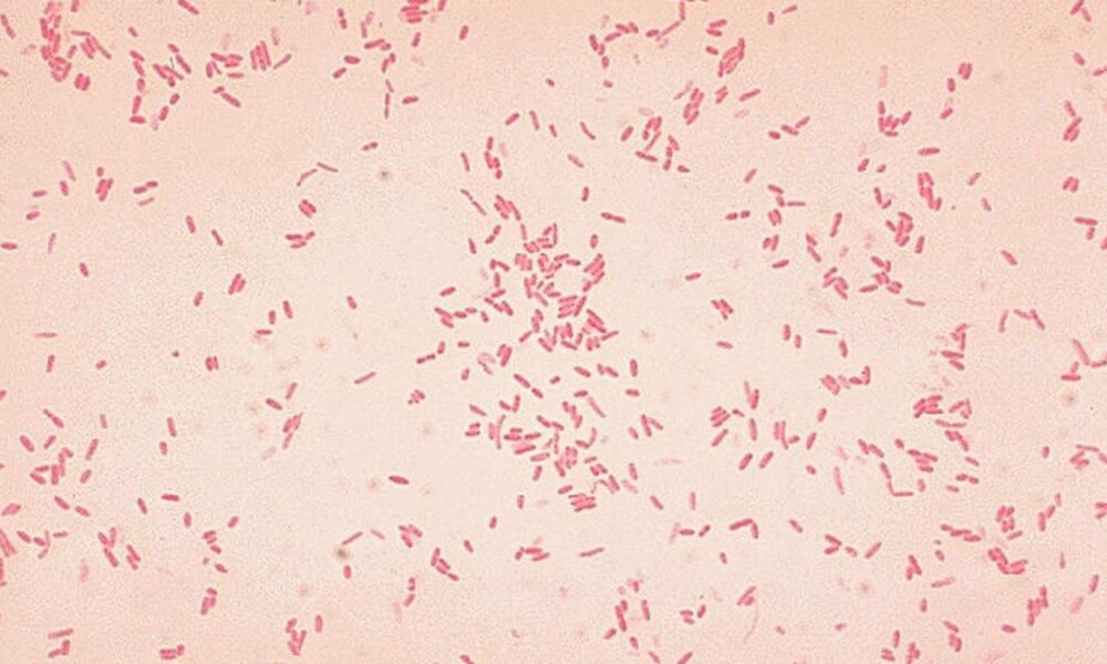 Microbe might spark first stages of ulcerative colitis: new study