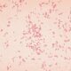 Microbe might spark first stages of ulcerative colitis: new study