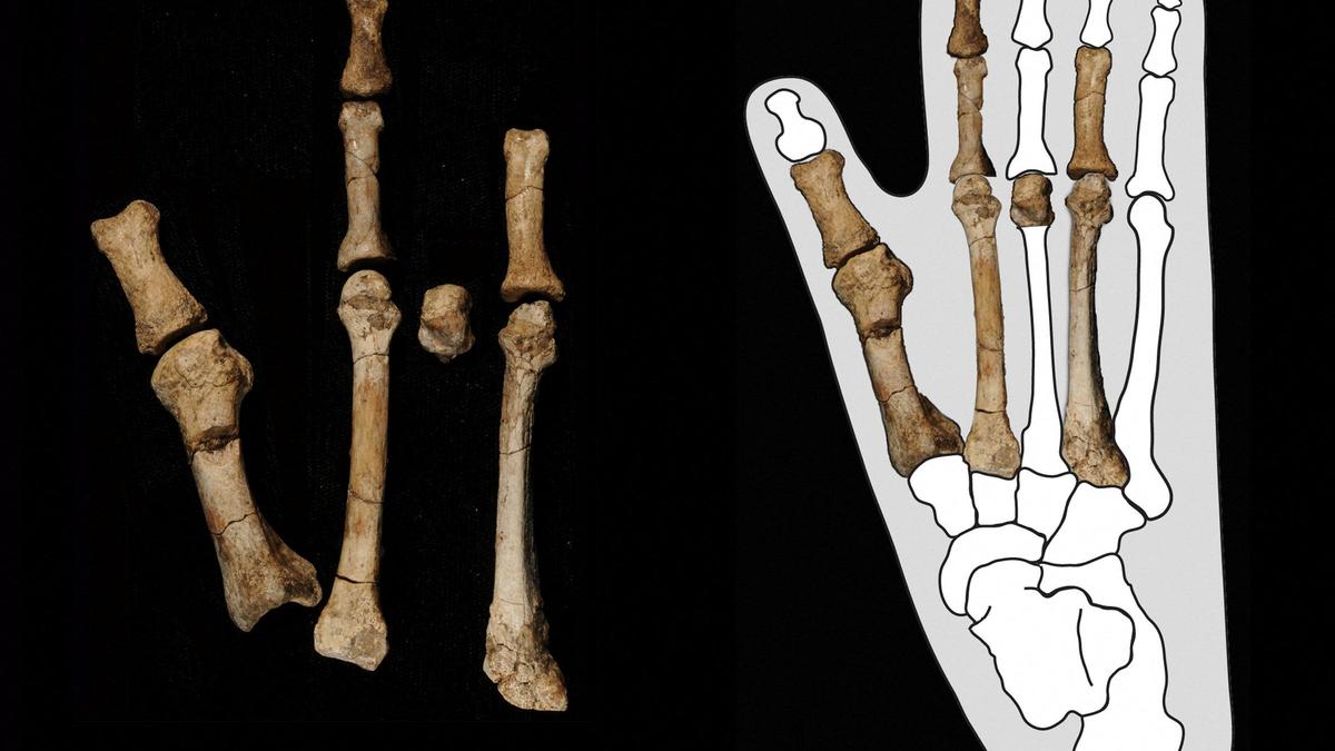 Scientists solve mystery of prehistoric 'Burtele Foot'