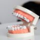 Why do we have wisdom teeth?