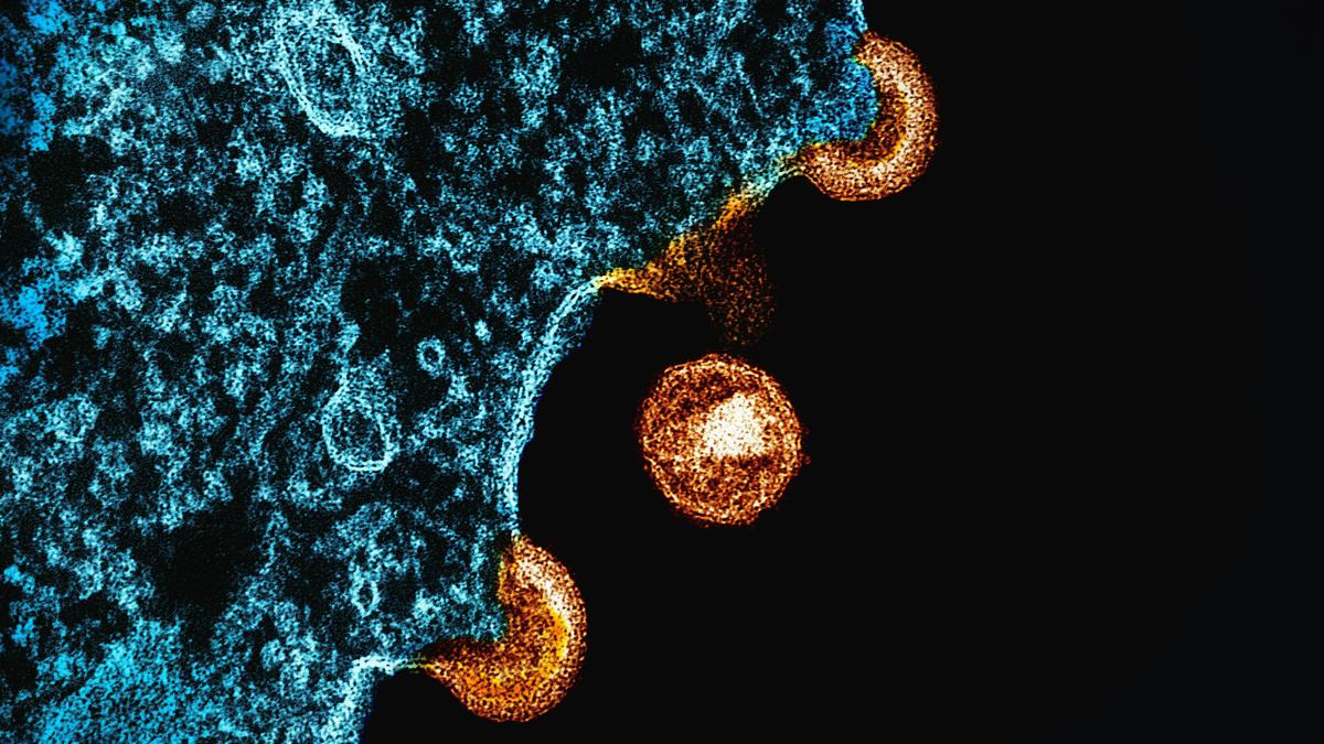 World AIDS Day: why HIV infections are still so hard to treat