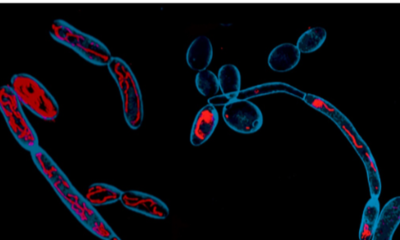 CCMB scientists identify metabolism as new target for antifungal therapies