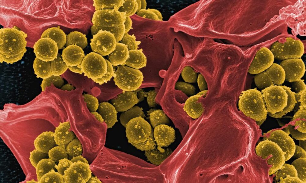 Study unravels why men experience more skin infections than women
