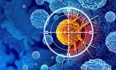 Cancer immunotherapy may reshape brain’s barrier to metastasis