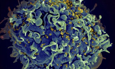 Small study hints that revving up immune cells might help fight HIV