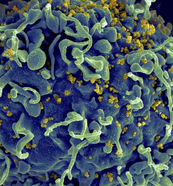 Small study hints that revving up immune cells might help fight HIV